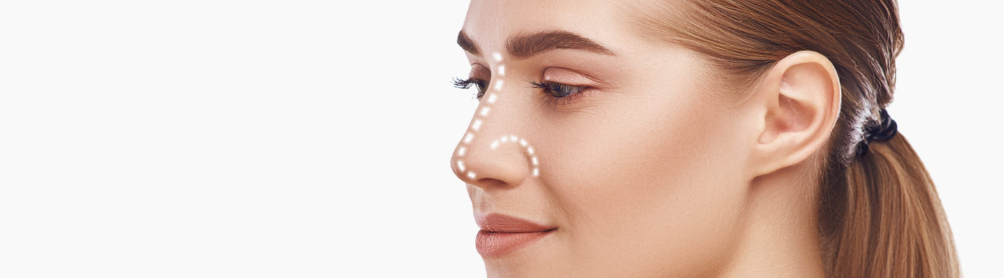 Rhinoplasty