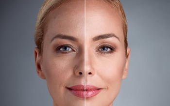 TOP TREATMENTS TO FIGHT THE 7 SIGNS OF AGEING