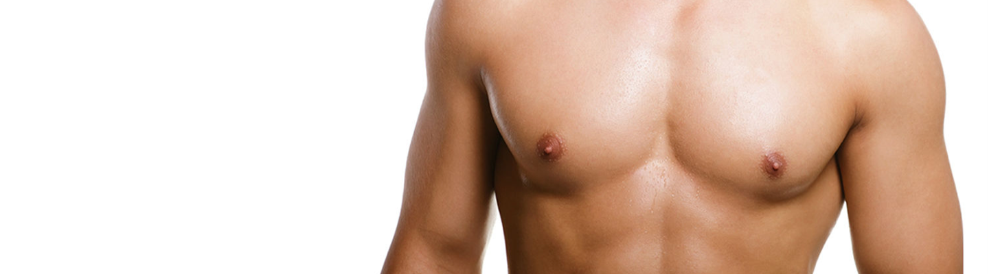 Gynecomastia