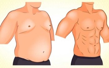 Are you a good candidate for Gynecomastia Surgery?