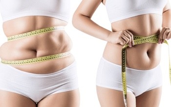 Things You Need to Know Before Liposuction