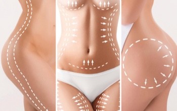 Liposuction Costs in Turkey