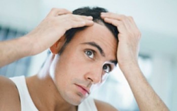 The things to consider before hair transplantation