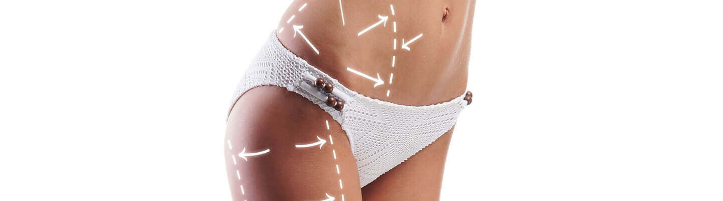 Liposuction in Turkey