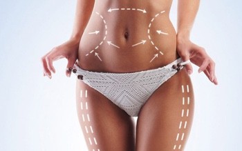10 things to know and 10 questions to ask for Liposuction
